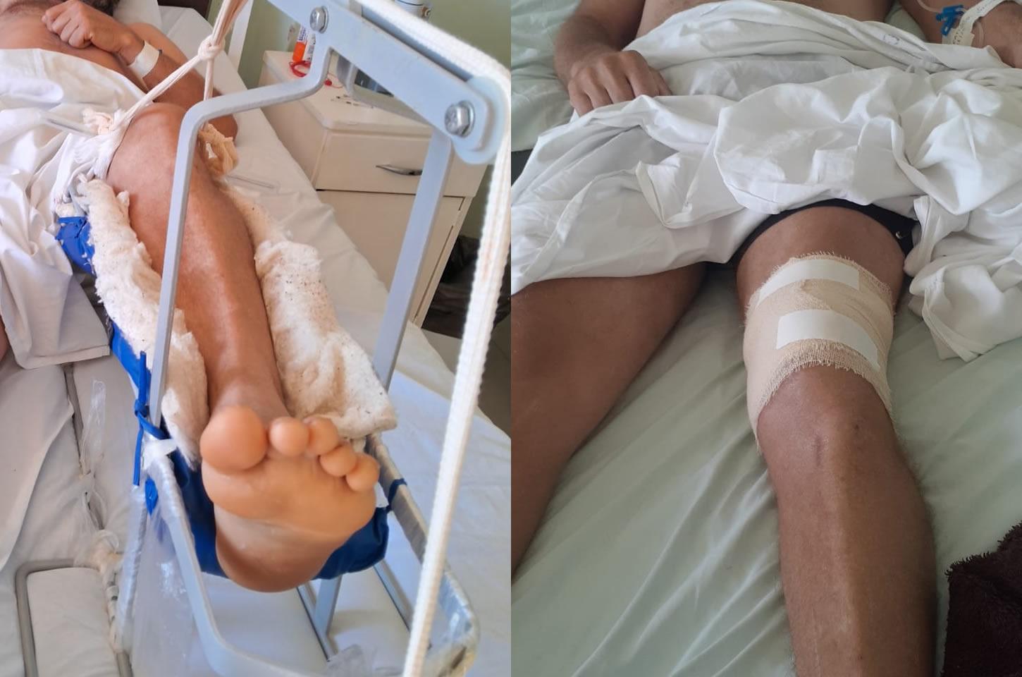 Família de Marcos cria vaquinha online para custear cirurgia após acidente de trabalho